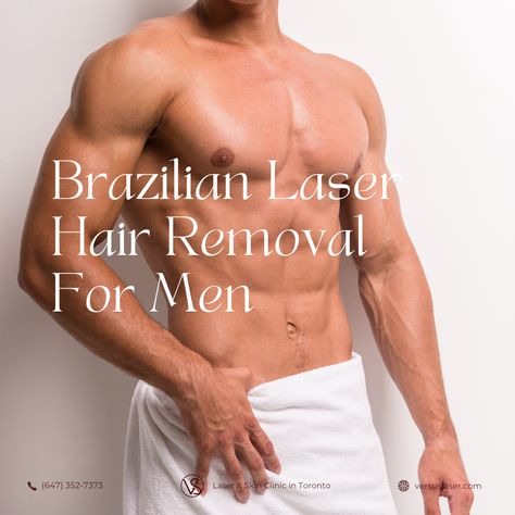 Up to 40% OFF Men’s Private Area Laser Hair Removal. Limited time offer!* Get offer: https://www.versuslaser.com/promotions/#brazilianmen Packages on Sale: 🖤 MALE BRAZILIAN (Front): $499 (Reg. $799), 6 sessions in total. 🖤 MALE BRAZILIAN & ANUS (Front & Back): $699 (Reg. $1,119), 6 sessions in total. 💚 VS MedSpa Laser & Skin Clinic in Toronto: #laserhairremoval #medicalaesthetician #laserclinic #hairremoval #shaving #VersusLaserClinic #vsmedspa #waxing #brazilian #malebrazilian Private Part Hair Removal, Laser Hair Removal Men, Laser Hair Removal Facts, Laser Depilation, Laser Hair Removal Brazilian, Brazilian Hair Removal, Upper Lip Hair Removal, Back Hair Removal, Leg Hair Removal