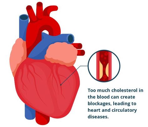 signs of high cholesterol on face,
what causes high cholesterol in women,
what can cause a sudden increase in cholesterol,
causes of high cholesterol in healthy person,
signs of high cholesterol in females,
my cholesterol is 7.1 is that high,
my cholesterol is 250 is that high,
what are the 5 signs of high cholesterol, Sport Drawing, Pencemaran Udara, Heart Blockage, Lower Cholesterol Naturally, Health Heart, Clogged Arteries, Healthy Cholesterol Levels, Healthy Lifestyle Habits, Low Cholesterol