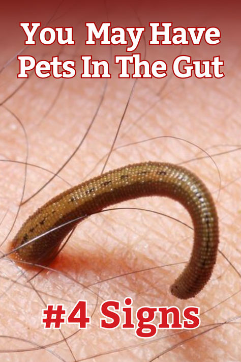 4 Signs You May Have a Parasite in Your Gut: • Stomach pain or cramps. • Bloating and gas. • Diarrhea or constipation. • Unexplained nutrient deficiencies. #GutHealth #ParasiteAwareness #HealthTips #WellnessJourney Stomach Cramps Causes, Guy Health, Parasite Cleanse, Skin Rashes, Stomach Cramps, Bile Duct, Eye Vitamins, Digestive Issues, Nutrient Deficiency