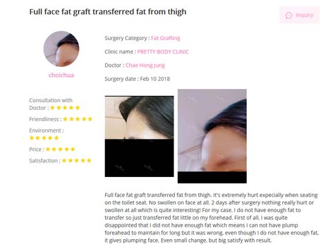 Fat grafting on forehead,  Plump your flat forehead and it looks much younger looking after transplanting your own fat! More information Why not?! M. +82 10 4095 0781 E. prettybodyeng@gmail.com Flat Forehead, Pretty Body, Fat Grafting, More Information, Surgery, Seoul, Turn Ons, 10 Things, Instagram