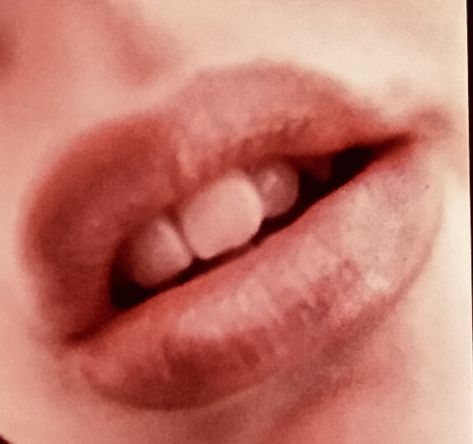 Dirty lip, MY LIPS Lips Aesthetic, Dry Cracked Lips, Cracked Lips, Aesthetic Boy, Chapped Lips, Lips