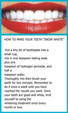 Baking Soda Teeth, Natural Teeth Whitening Diy, Baking Soda Teeth Whitening, Teeth Whitening Homemade, Teeth Whitening Remedies, Teeth Whitening Diy, Teeth Health, Home Health Remedies, Natural Teeth Whitening