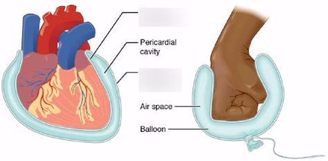 Write: parietal vs visceral 2 | Quizlet Ventral Cavity, Anatomical Terminology, Free College Textbooks, Serous Membrane, Thoracic Cavity, Biology Worksheet, College Textbook, Free Textbooks, Cerebrospinal Fluid