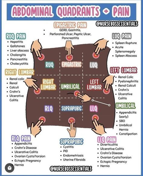 Abdominal Quadrants + Pain #nursingschool #nursingstudent #study  - Image Credits: nursesbossessentials Nursing Tools, Nursing School Studying Cheat Sheets, Medical Terminology Study, Paramedic School, Nclex Review, Nursing Assessment, Nursing School Essential, Nursing Study Guide, Medical School Life