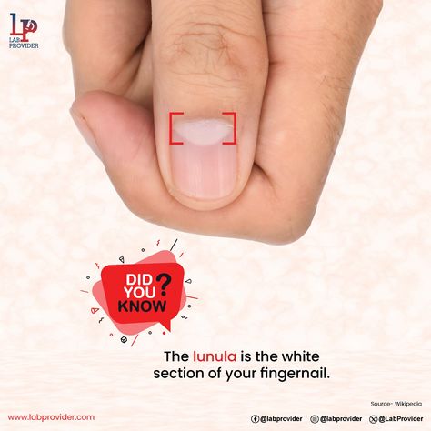 The visible area of the distal nail matrix that extends beyond the proximal nailfold is known as the lunula. It is white, half-moon-shaped, occurs by week 14 of pregnancy, and has distinct histopathological characteristics. The lunula is primarily responsible for defining the free margin of the distal nail plate. Nail Plate, Do You Know What, Moon Shapes, Half Moon, Did You Know, No Response, Nails