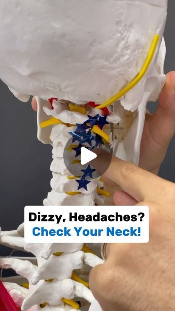 Dr. Joe Damiani - TMJ, Head & Neck Specialist on Instagram: "Comment the word ‘NECK’ on this video if you need help fixing neck issues that might also be causing headaches, or dizziness.  Do you experience Neck stiffness on one side? Do you also experience headaches, dizziness, or burning eyes? Well restriction in the cervical spine can absolutely lead to not only neck pain itself, but also uncomfortable head symptoms. In this video I show you how to assess your neck, specifically the upper neck during rotation, which is one of the most common limitations when we see associated head symptoms.  From there there’s a two step exercise process you can use to start reducing symptoms. Give it a try.  #neckpain #neckpainrelief #headaches #headacherelief #dizziness #dizzy #dentistryworld #neurolog Cervical Neck Pain Relief, Exercise For Migraines Headache Relief, How To Reduce Headaches, How To Decompress Your Neck, Base Of Neck Pain, Neck Decompression, Cervical Spine, Cervical Spine Exercises, Cervical Pain Exercises