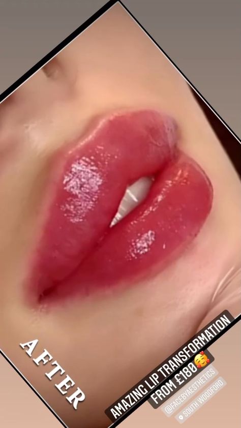 Bow Lips Shape, No Cupid Bow Lips, Bow Shaped Lips, Cupid Lips Shape, Perfect Cupids Bow Lips, Cupid Bow Lips Aesthetic, Cupids Bow Lips, Desired Appearance, Cupid Bow