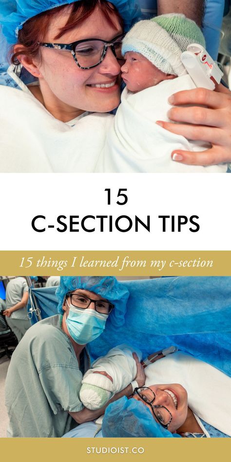 I give you 15 tips I learned with my C-Section so you can consider them when making your birth plan. About recovery, hospital bag, hormones, what to expect. My birth experience left a scar. A scar that reminds me of the sweetest gift, my amazing baby daughter! I had a cold c-section. My original preference was an elective scheduled c-section | Birth Planning. C-Section Recovery Timeline | Shalan Trotz Premo - Studioist C Section Birth Plan, C Section Recovery Timeline, Cesarean Recovery, Elective C Section, Scheduled C Section, C Section Recovery, Cesarean Section, Baby Daughter, Things I Learned