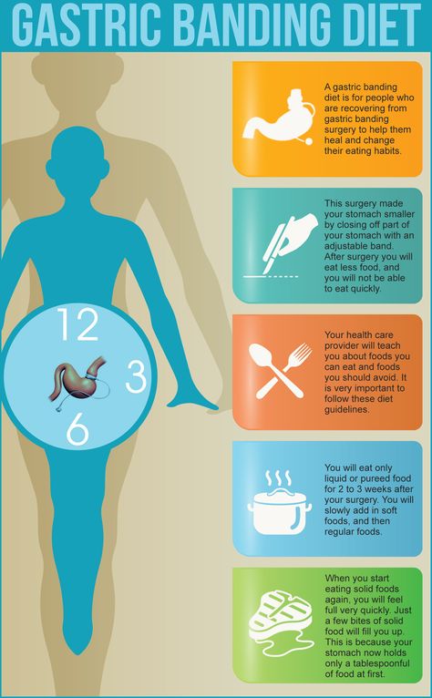 Gastric Surgery, Lap Band, Gastric Band, Changing Habits, After Surgery, How To Eat Less, Health Info, Eating Habits, Surgery