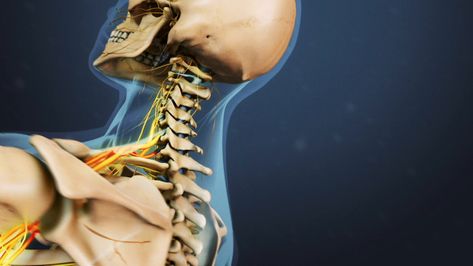 Outpatient Anterior Cervical Discectomy and Fusion (ACDF) | Spine-health Neck Sprain, Occipital Neuralgia, Text Neck, Cervical Spondylosis, Soft Tissue Injury, Forward Head Posture, Neck Surgery, Spine Health, Spine Surgery