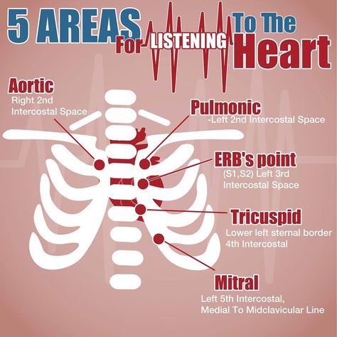 Ape to man Paramedic School, Heart Sounds, Nursing Mnemonics, Neonatal Nurse, Cardiac Nursing, Nursing School Survival, Professional Nurse, Best Nursing Schools, Nursing Profession