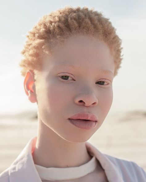 Albino Black People, Albino Model, Brown Girls Makeup, People References, Face Study, Art Photography Portrait, Face Reference, We Are The World, Oc Ideas