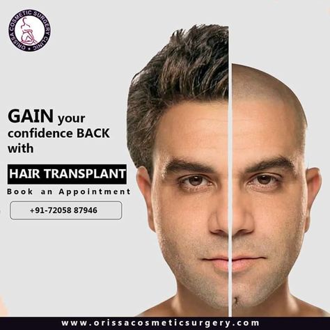 For many people, a hair transplant can help bring back the lost confidence and the look back.  To know more about the Procedure Click the Link Below http://orissacosmeticsurgery.com/ http://nosereshapingindia.com/  To Book an Instant appointment Click : http://orissacosmeticsurgery.com/  Call Us 📞 +91-72058 87946 For Consultation with Our Expert Plastic & Cosmetic Surgeon Dr. Akshay Kumar Rout !!  #ocsc #drakshayrout #bestsurgeoninbhubaneswar #placticsurgery #plasticandcosmeticsurgeon #plastics Lost Confidence, Plastic Surgery Clinic, Nose Reshaping, Happy Independence Day India, Hair Fixing, Brand Ideas, Akshay Kumar, Breast Augmentation, Hair Transplant