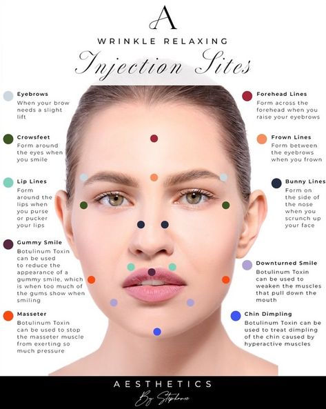 Face Injections, Botox Injection Sites, Injection Sites, Facial Aesthetic, Botox Wrinkles, Facial Injections, Face Procedures, Botox Injection, Face Fillers