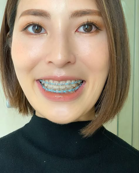 Braces Colour Ideas, Pretty Braces, Power Chain Braces, Braces Girl, Behel Gigi, Teeth Nails, Power Chain, Girls With Braces, Adult Braces