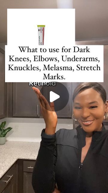 Rita (Chinenye) on Instagram: "What to use for Dark Knees, Elbows, Underarms, Knuckles, Melasma, & Stretch Marks. - #hyperpigmentationsolution #retinoid #sunscreen #eucerin #glycolicacid #theordinaryskincare #stretchmarks #darkknees #darkelbows #darkknuckles" Dark Spots On Hands How To Remove, Dark Neck Remedies, Dark Knees, Dark Knuckles, Strech Marks, Dark Elbows, Stretch Mark Remedies, Dark Spots On Face, The Ordinary Skincare