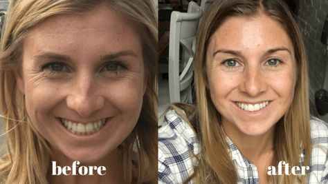 Vital Proteins Review | Before and After Picture, Too Collagen Peptides Benefits, Taking Collagen, Celebrity Yearbook Photos, Vital Proteins Collagen Peptides, Collagen Benefits, Beauty Water, Vital Proteins, Hair Protein, Yearbook Photos