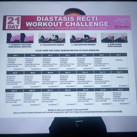 Diastasis Recti Challenge 21 Days, Diastis Recti 30 Day Challenge, Diasis Recti, Diastasis Recti Challenge, Diastasis Exercises, Diastasis Recti Workout, Diastis Recti, Weight Training For Fat Loss, Waist Training Workout