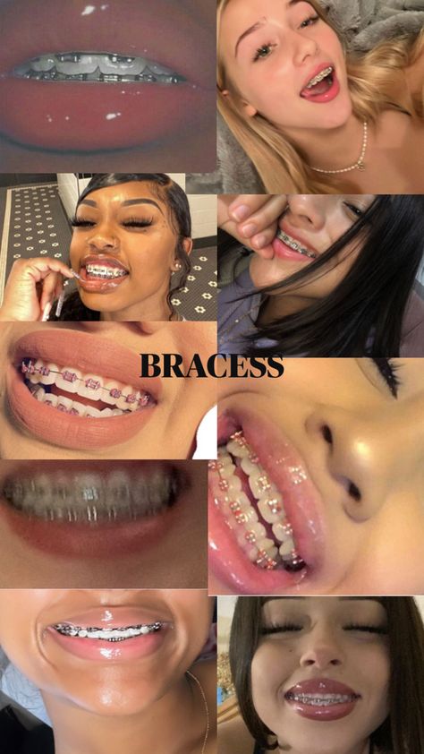 NOT MINE Braces For Dark Skin, Braces Dark Skin, Baddies With Braces, Cute Baddies, Brave Girl, You Are Beautiful, No Matter What, Braces, Not Mine