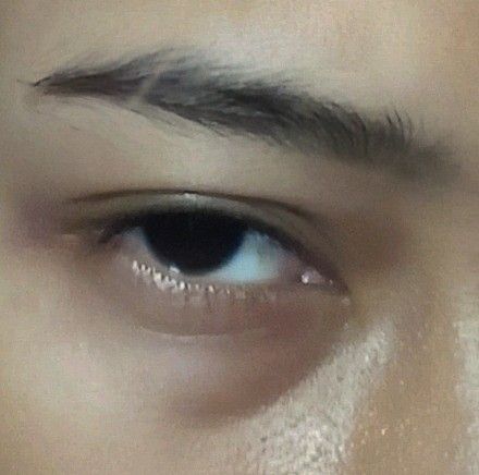 idk why I posted this pic.. I just thought it looked cool, I hate my eyebag sm ngl Aesthetic Eyebags, Eyebags Makeup Aesthetic, Sunken Eyes Aesthetic, Lazy Eyes Aesthetic, Asian Eyes Aesthetic, Eyebag Aesthetic, Eye Bags Aesthetic, Down Turned Eyes, Orange Homescreen