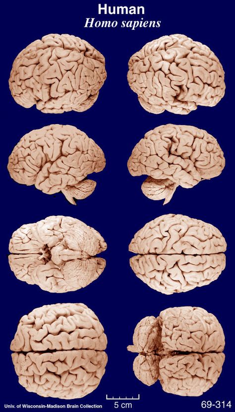 brain poster Brain Reference, Brain Sculpture, Neurosurgery Study, Real Brain, Brain Study, Hands Sculpture, Brain Painting, Anatomy Aesthetic, Brain Poster