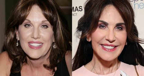 The author is opening up about the cosmetic procedure that gave her a boost of confidence. Robin Mcgraw Plastic Surgery, Robin Mcgraw, Dr Phil Show, Eyebrow Transplant, Plastic Surgery Photos, Celebrity Plastic Surgery, Dr Phil, Under The Knife, Botox Injections