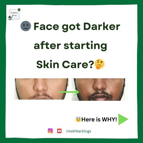 🌚 Face got Darker after starting Skin Care?🤔 😨Here is WHY!👇 ‼️It’s possible that your skin is reacting to a new product or ingredient in your skincare routine.‼️ 1. Photosensitivity: Some skincare products, especially those with ingredients like retinol or certain acids (like AHAs and BHAs), can make your skin more sensitive to the sun. This can lead to darkening if you’re not using adequate sun protection. 2. Hyperpigmentation: If your skin is irritated or inflamed by a product, it can ... Retinol, Skincare Routine, Skincare Products, Sun Protection, New Product, The Sun, Skin Care, Sun, Skin