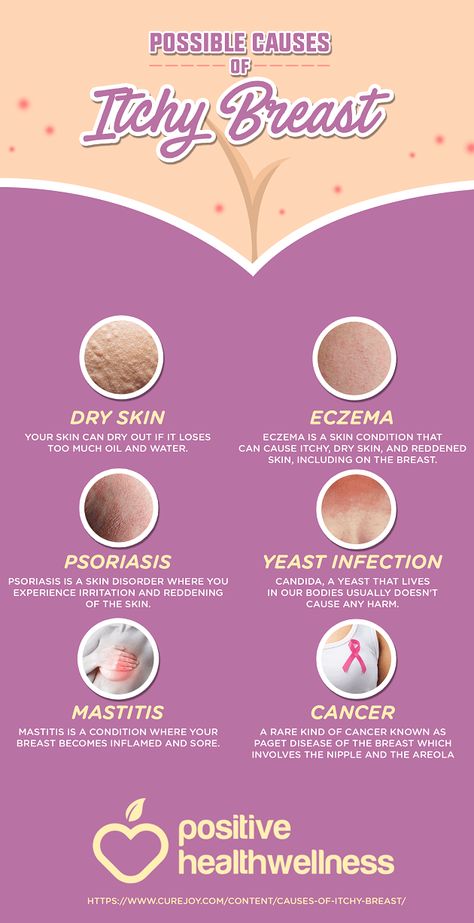 6 Possible Causes Of Itchy Breast – Positive Health Wellness Infographic Pagets Disease, Best Acne Products, Magic Tattoo, Feminine Health, Breast Health, Skin Disorders, Natural Home Remedies, Health Facts, Health Benefits