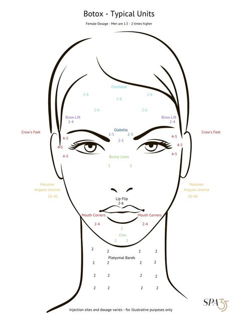 Change Drawing, Botox Forehead, Botox Injection Sites, Dermal Fillers Lips, Injection Sites, Botox Injection, Botox Before And After, Face Fillers, Laser Skin Resurfacing