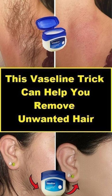 This Vaseline Trick Can Help You Remove Unwanted Hairs Permanent Hair Removal Cream, Upper Lip Hair Removal, Back Hair Removal, Electrolysis Hair Removal, Lip Hair Removal, Best Hair Removal Products, Remove Unwanted Facial Hair, Unwanted Hair Growth, Remove Unwanted Hair