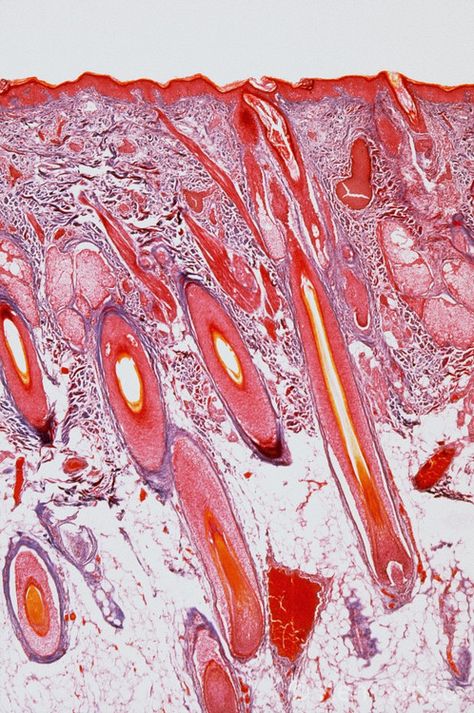 Skin under microscope. Pretty! Like marbled paper. Could we use microscopes in Dana Hall to look at a wide range of skins here at UB? Skin Under Microscope, Microscope Art, Microscopic Photography, Wood Photography, Microscopic Images, Tiger Skin, Body Map, Woods Photography, Skin Tissue