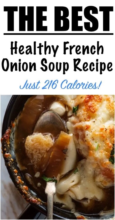 Healthy French Onion Soup, Easy Onion Soup Recipe, Healthy Detox Soup, Low Calorie Soup Recipe, Homemade French Onion Soup, 500 Calories Recipes, Onion Soup Recipe, French Soup, Low Calorie Soup