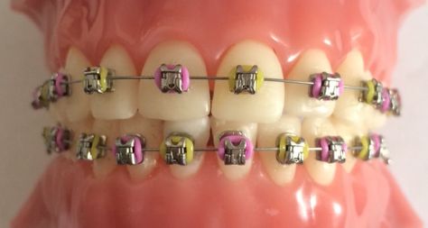 Easter themed elastics for braces. Easter Color, Braces Colors, About Easter, Easter Colors, Easter Design, Bullet Journal Ideas Pages, Halloween Coloring, Color Themes, Braces