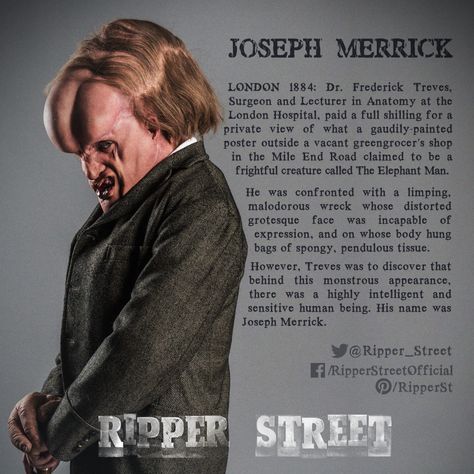 Joseph Merrick - Joseph Drake John Merrick, Joseph Merrick, Medical Museum, London Hospital, Police Precinct, Human Oddities, Ripper Street, British Tv Series, Bbc Tv Series