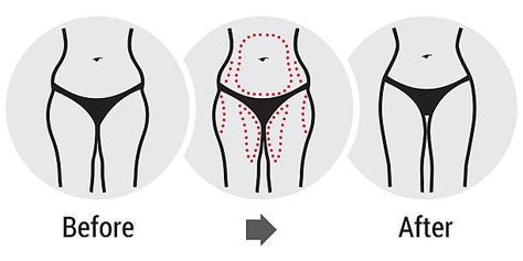 Transforming Your Hips: Before and After Hip Dips | by Ari Mars | Mar, 2023 | Medium What Are Hip Dips, Healthy Holistic Living, Fit Girl Motivation, Business Card Modern, Fat Removal, Beginner Workout, Burn Fat Faster, Fat Burning Workout, Lose Body Fat