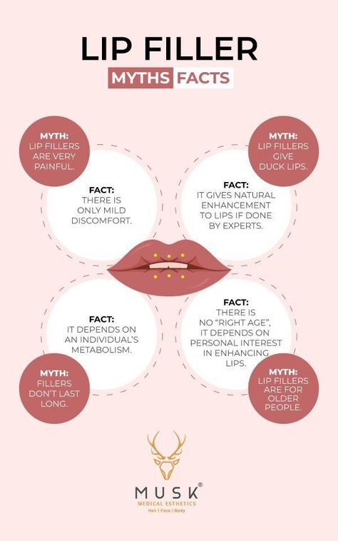 Lip filler myths facts #lip #lips #pinklips #filler #lipstick Lip Filler Myths, Botox Myths And Facts, Beauty Treatments Aesthetic, Lip Filler Instagram Post, Botox Myths, Lip Filler Quotes, Botox Facts, Injection Room, Botox Business