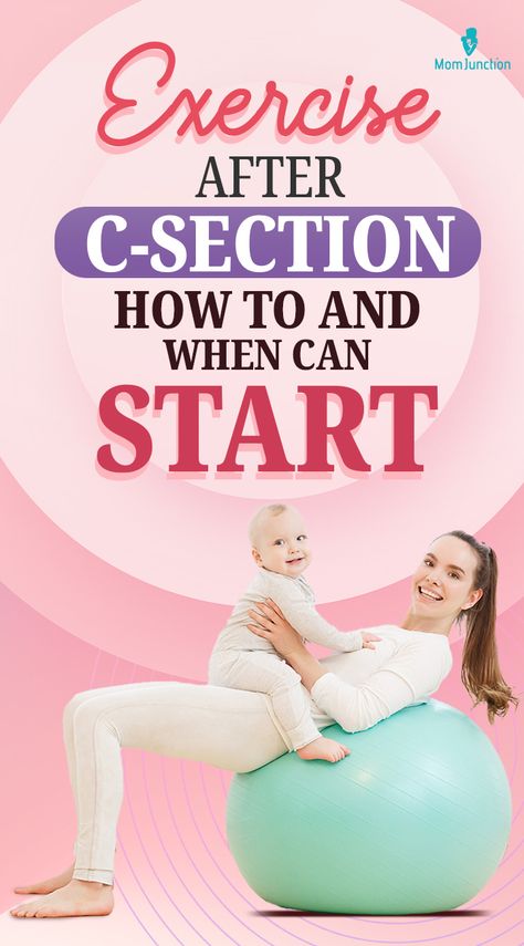 Are you keen to shed those extra pounds that you piled up during your pregnancy? Are you looking forward to getting a flat tummy after sporting the baby bump for months? Did you have a cesarean delivery and are wondering when you can work out to get back in shape? Getting back to exercise after c section delivery can be a little tricky. Read on to know when it is safe for you to start exercising again. Exercise After C Section, C Section Delivery, Start Exercising Again, After C Section Workout, C Section Workout, Postpartum Tummy, Cesarean Delivery, Burn Belly Fat Drinks, Home Workout Routine