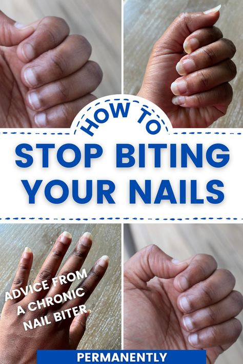 Check out how I stopped nail biting as an adult. Nail Biting Remedies, Biting Fingernails, Nail Biting Habit, Biting Nails, Nail Remedies, Grow Nails Faster, Nail Picking, Nail Care Routine, How To Grow Nails