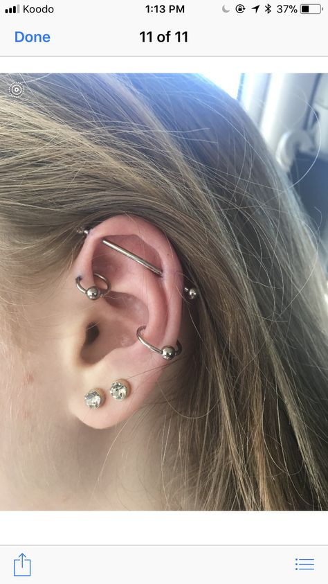 Industrial, forward helix, and conch freshly pierced Industrial And Forward Helix Piercing, Forward Helix And Industrial Piercing, Ear Peicerings Ideas, Industrial And Conch Piercing, Conch And Industrial Piercing, Industrial And Helix Piercing, Industrial Piercing Aesthetic, Forward Helix Piercing, Geode Jewelry