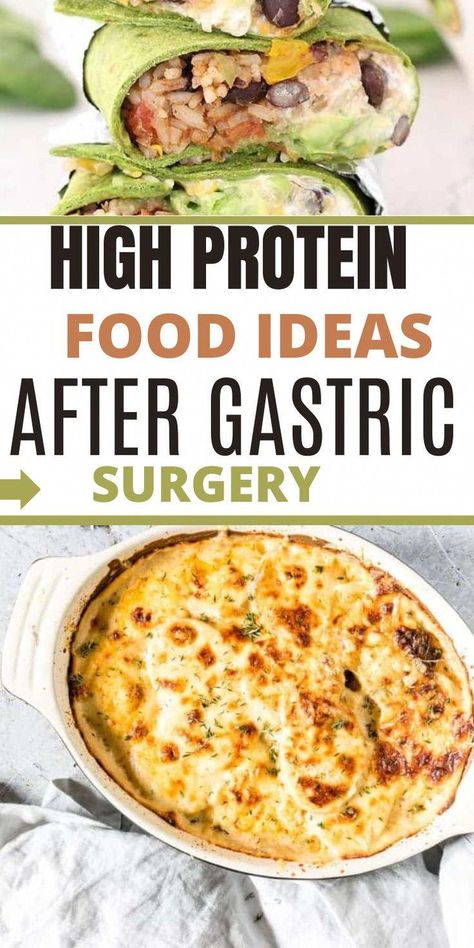 Are you looking for bariatric recipes gastric bypass high protein low carb foods that are tasty and filling? We’ve compiled a list of easy for Gastric Bypass Patients that are high in protein perfect to help you in your weightloss journey.Low Carb Recipes|Bariatric Recipes|Bariatric Surgery #NoCarbDietRecipes High Protein Bariatric Recipes, Full Liquid Diet, Liquid Diet Recipes, Bariatric Recipes Sleeve, Gastric Bypass Recipes, Bariatric Meals, Soft Foods Diet, Low Carb Foods, High Protein Meals