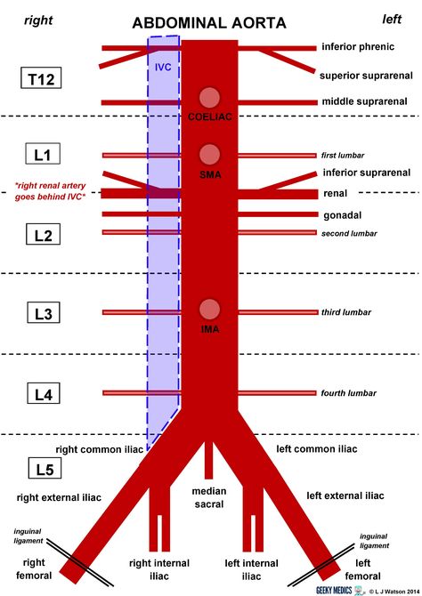 Print Anatomy of the Arteries of the Trunk - Lecture 5 flashcards | Easy Notecards Arteries Anatomy, Abdominal Aorta, Vascular Ultrasound, Diagnostic Medical Sonography, Interventional Radiology, Vascular Surgery, Medicine Notes, Gastrointestinal System, Medical Student Study