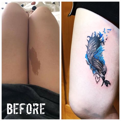 Feather tattoo birthmark coverup by Esther C Tattoos That Cover Birthmarks, Birthmark Tattoo, Independent Tattoo, Branded Pins, Gorgeous Tattoos, Best Tattoos, Stomach Tattoos, Celtic Tattoos, Feather Tattoo