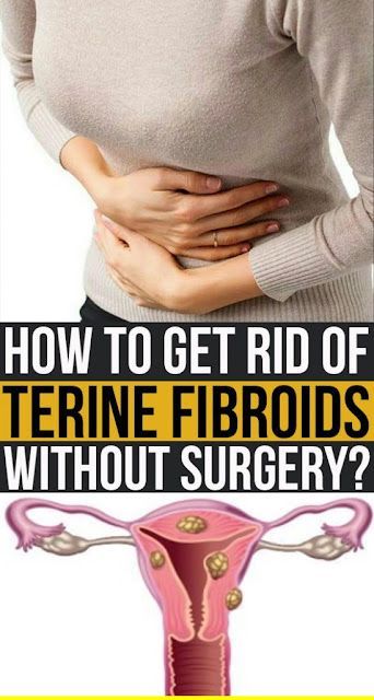 How to Get Rid of Uterine Fibroids without Surgery Testosterone Therapy, Health Articles Wellness, Low Porosity Hair Products, Menstrual Cramps, Good Health Tips, Health Articles, Natural Treatments, Health Issues, Wellness Tips