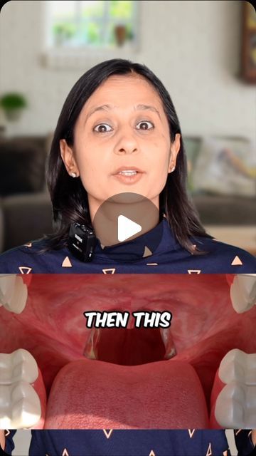 Throat Pain Remedies, Strep Throat Pictures, Ayurveda Food, Swollen Tonsils, Ayurveda Recipes, Throat Pain, Feeling Better, Simple Home, Sore Throat