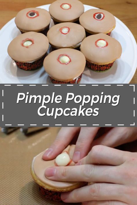 Need an awesome Halloween recipe? Make these funny pimple popping cupcakes. They are a perfect gag treat for any party. They make look gross but oh so fun to pop! Gross Looking Food For Halloween, Gross Desserts For Halloween, Halloween Desserts Gross, Gross Looking Food, Halloween Food Gross, Gross Halloween Treats, Gross Looking Halloween Food, Gross Halloween Food Ideas For Parties, Pimple Cupcakes