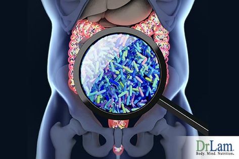 Even with normal inflammatory markers, metabolism can be disrupted. Understand what underlying symptoms may be disguising serious illness conditions. Nutrition For Athletes, Vedic Science, Lactobacillus Reuteri, Healthy Microbiome, Adrenal Health, Soul Care, Prebiotics And Probiotics, Gut Microbiota, Healthy Herbs