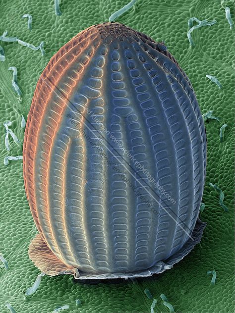 SEM a Monarch Butterfly Egg (Danaus plexippus). aid on the underside of a common milkweed leaf (Asclepias syriaca). The milkweed plant serves as the primary food source for monarch butterflies as well as a host for the monarchs eggs and larvae. This images was collected at 50x and represents a field of view .5mm wide. Butterfly Eggs, Science Photography, Insect Eggs, Electron Microscope Images, Scanning Electron Microscope, Eggs Image, Microscopic Photography, Milkweed Plant, Micro Photography