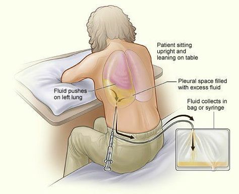 Radiology Nursing, Interventional Radiology, Nursing Diagnosis, Nursing Student Tips, Surgical Nursing, Medical Surgical Nursing, Nursing School Survival, Respiratory Therapy, Nursing School Studying