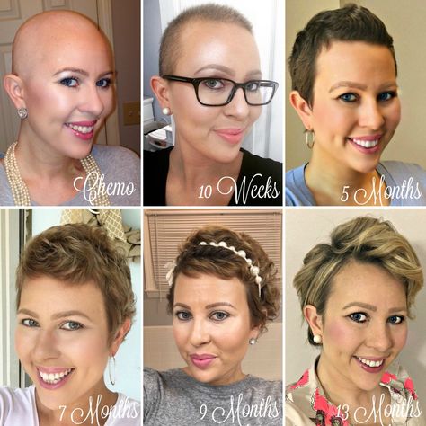 1 Year Hair Growth, Hairstyles After Chemo, Hair After Chemo, Chemo Curls, Hair Growth Stages, Hair Growth After Chemo, Prom Hair Styles, Hairstyles Anime, Chemo Hair