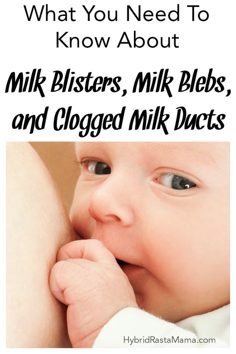 Do you have pain and soreness as a result of breastfeeding? Noticing some blister-like pimples on your nipples? Learn everything you need to know about milk blebs, milk blisters, and clogged milk ducts + how to get relief naturally from HybridRastaMama.com. She's had them ALL!! #milkblebs #nippleblisters #milkblisters #cloggedmilkducts #pluggedducts #mothersmilk #breastfeeding #sorebreasts Clogged Milk Duct Remedies, Milk Duct Clog, Milk Blister, Clogged Milk Duct, How To Heal Blisters, Blood Blister, Clogged Duct, Holistic Pet Care, Mother Milk